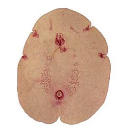   Psoraleococcus multipori  